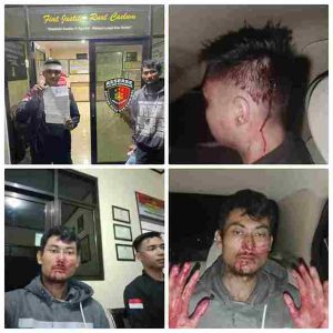 2 Orang Pengurus FWJ Indonesia Korwil Kuningan Dikeroyok 15 Orang Ngaku Ormas Al Jabar