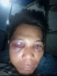 Ditetapkan Tersangka, Kades Rejosari Diduga Kirim Suruhan untuk Menganiaya Korban, Fakta Baru Mencuat di Polres Demak